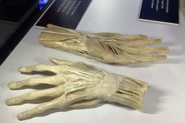 Pueblo Espanol und Ausstellung Bodies, Mallorca 03 / 2023 Pueblo Espanol und Ausstellung Bodies, Mallorca 03 / 2023